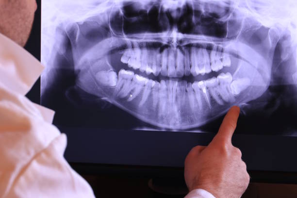 Best Emergency Dental Surgery in Reno, OH