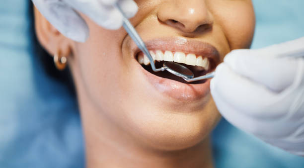 Best Emergency Tooth Extraction in Reno, OH