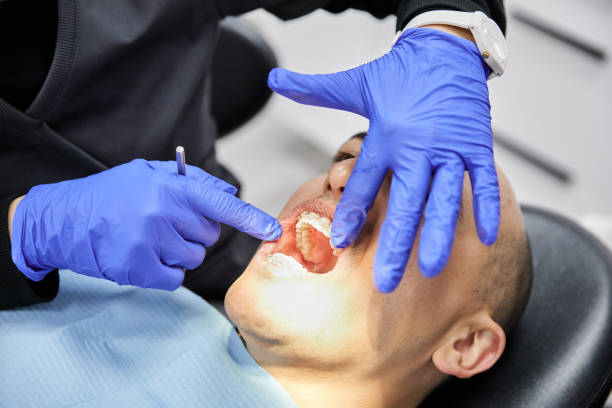 Best Emergency Dental Surgery in Reno, OH