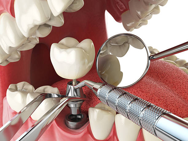 Best Walk-In Emergency Dentist in Reno, OH