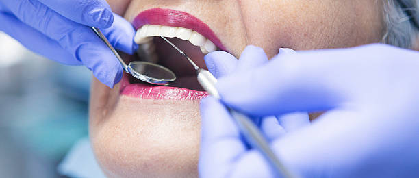 Best Same-Day Emergency Dentist in Reno, OH